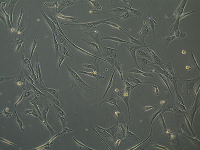 C�lulas estaminais mesenquimatosas (MSCs) do tecido do cord�o umbilical no tratamento de feridas cr�nicas