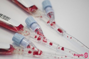 O que são células estaminais pluripotentes induzidas (iPSCs)?