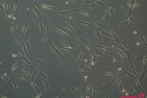 Células estaminais mesenquimatosas (MSCs) do tecido do cordão umbilical no tratamento de feridas crónicas