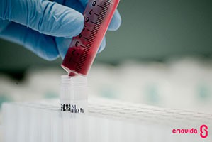 Células estaminais no tratamento de doenças cardiovasculares