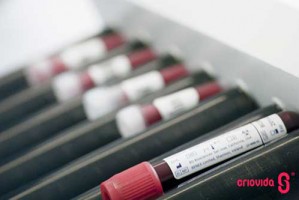 Utilização de células estaminais do tecido do cordão umbilical na regeneração de lesões de nervo periférico